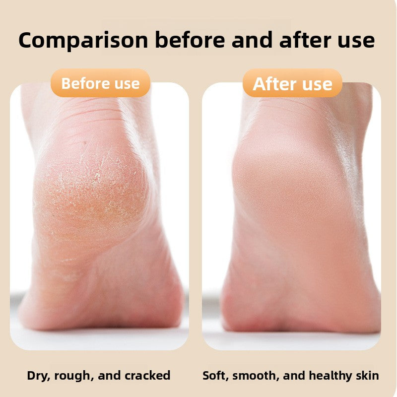 Electric Foot Grinder Dead Skin Remover product image